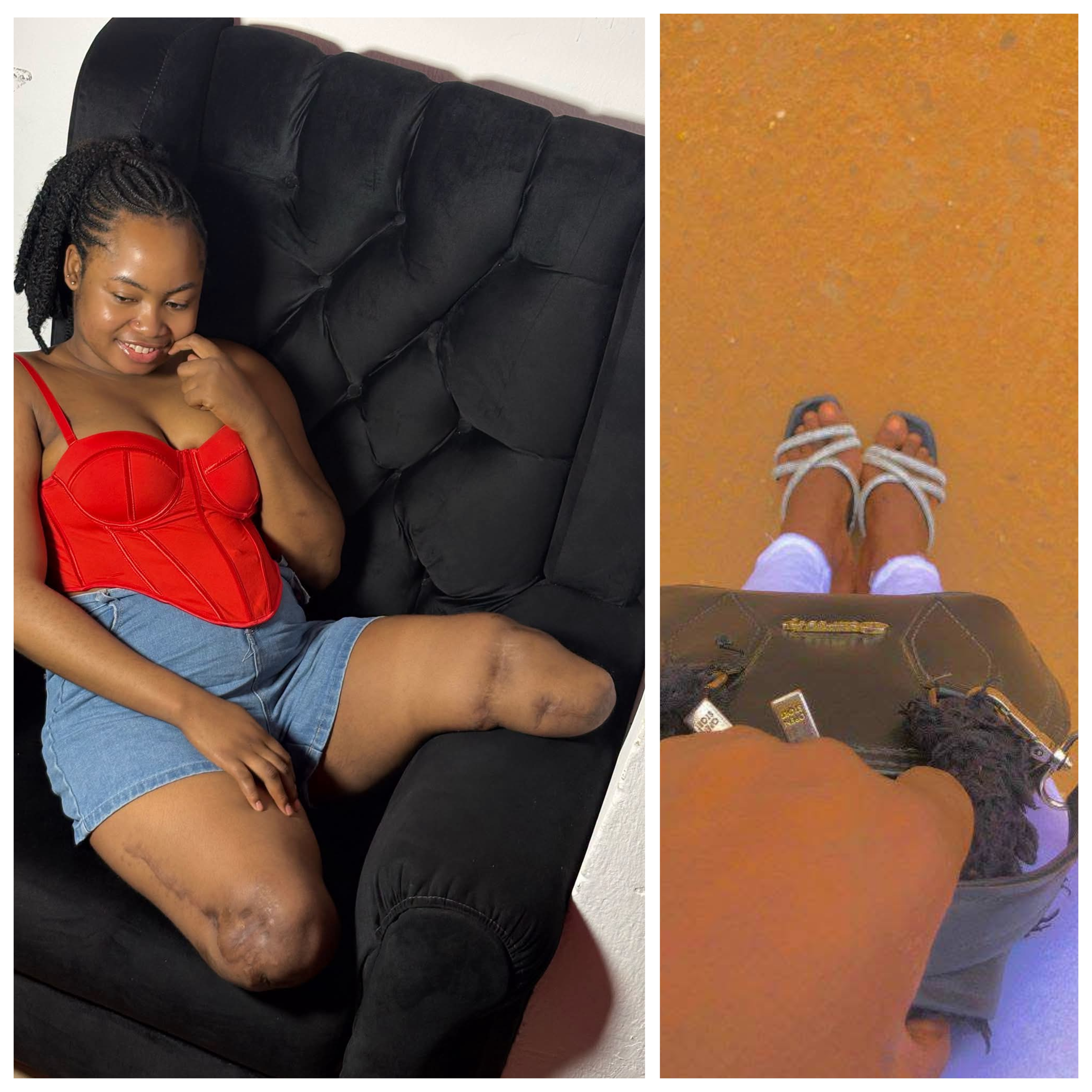 I wish I stayed home that day - Nigerian woman who lost both legs in accident shares her regrets