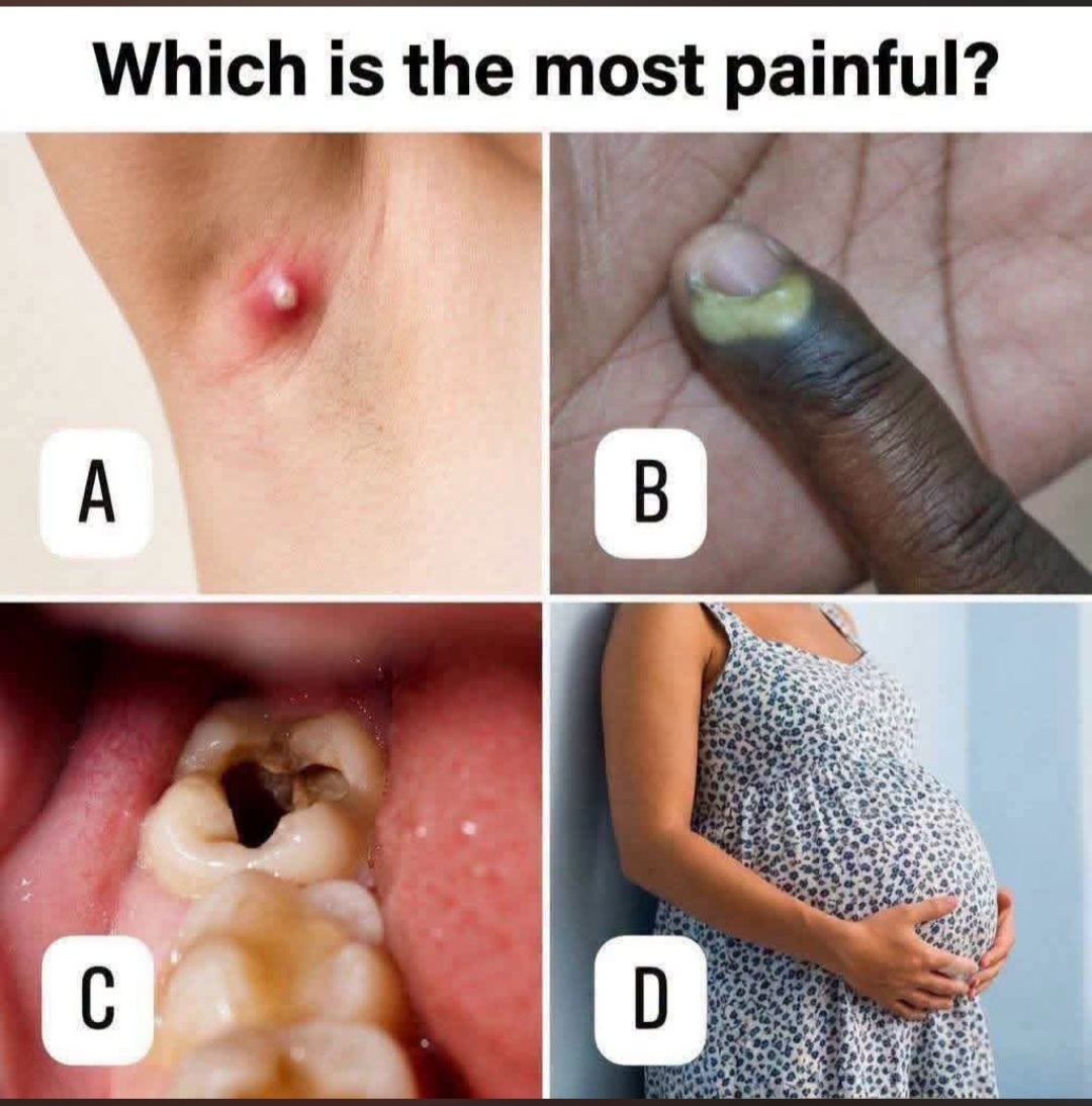 Which Of These Is Most Painful? (Photo)